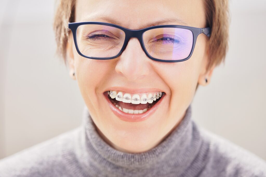 Orthodontics for Adults in Brentwood